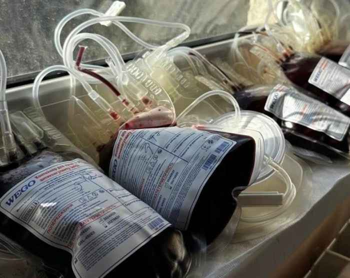 День донора для потреб ЗСУ провели в Ужгородській міській багатопрофільній клінічній лікарні

