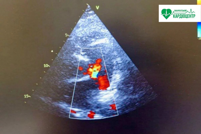 Вроджені вади серця без міфів: розмова з лікарем Закарпатського кардіоцентру Вікторією Сабов ІНТЕРВ’Ю