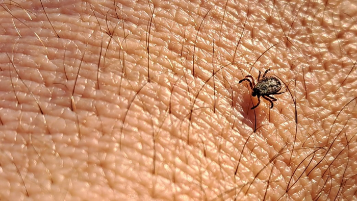 Три випадки хвороби Лайма з початку року: яка ситуація з укусами кліщів на Закарпатті
