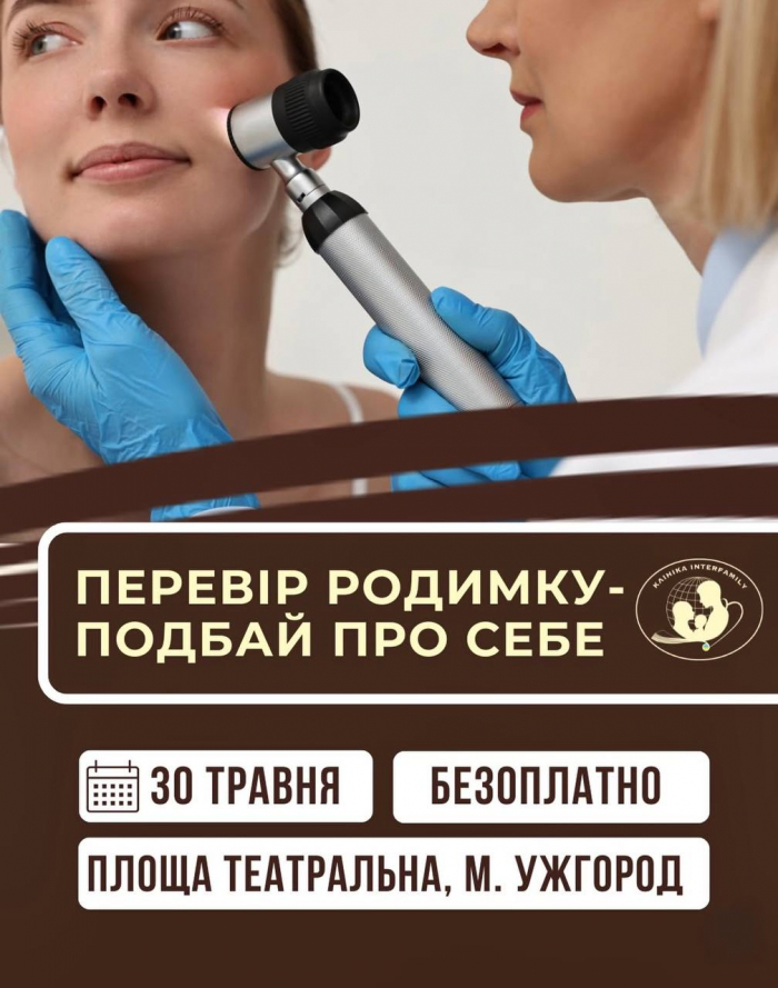 У суботу, 30 травня, в Ужгороді на площі Театральній безкоштовно перевірятимуть родимки